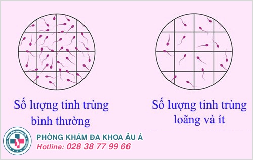 tinh trùng loãng