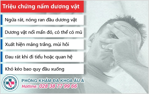 Các cách điều trị nấm dương vật được bác sĩ khuyên dùng