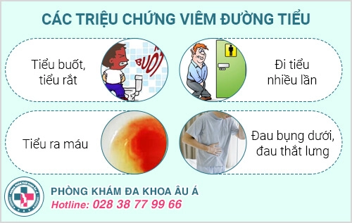 Những điều cần biết về viêm đường tiết niệu