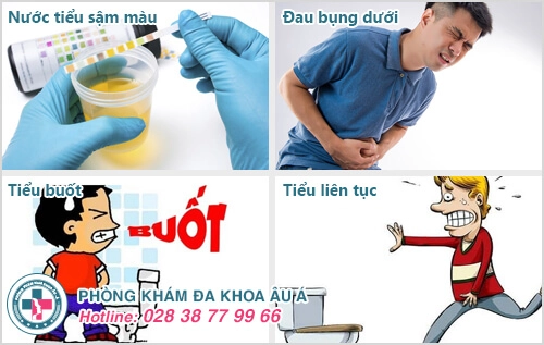 Viêm đường tiết niệu nam