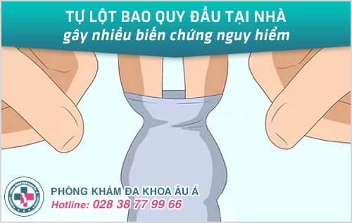 Những Biến Chứng Khi Tự Lột Bao Quy Đầu Tại Nhà