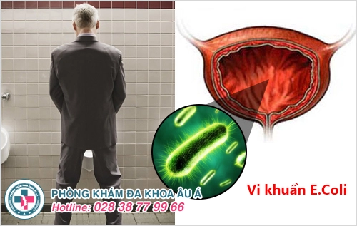 triệu chứng viêm đường tiết niệu