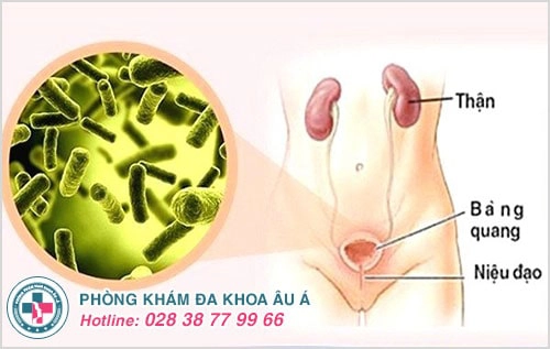 Viêm niệu đạo nữ căn bệnh không thể xem nhẹ
