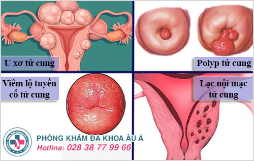 Vô sinh hiếm muộn, nguyên nhân do đâu?