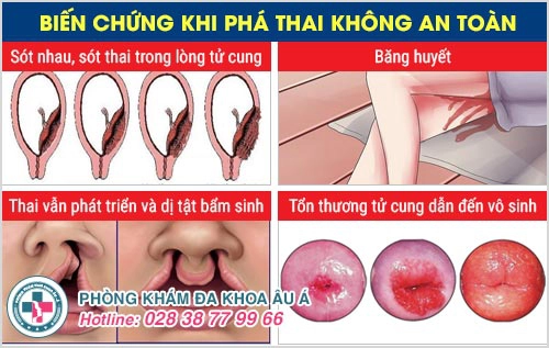 phá thai bằng thuốc