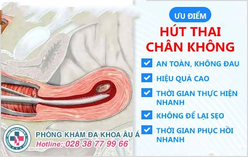 bỏ thai nhỏ　　