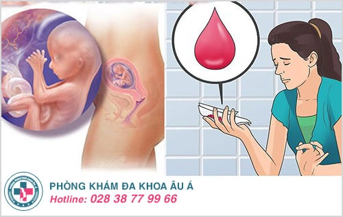Ra máu, dịch màu hồng - dấu hiệu dọa sảy thai dễ nhận biết