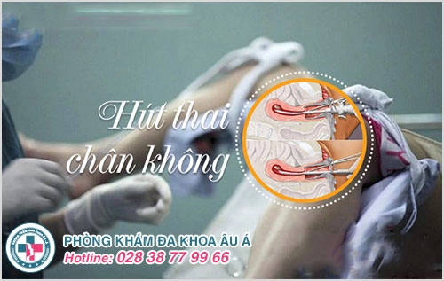 Hút thai theo tháng