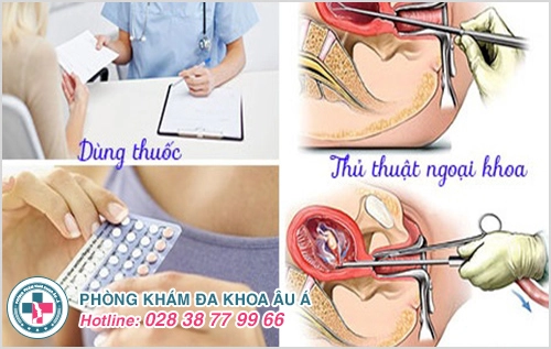 Các phương pháp chấm dứt thai kì an toàn