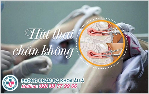 Phương pháp hút thai chân không
