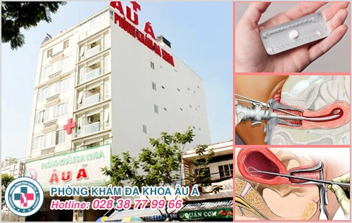Những thông tin liên quan đến hút thai chân không chị em nên biết