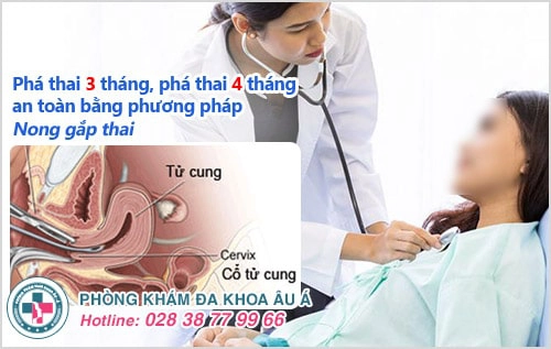 Phá thai 3 tháng, phá thai 4 tháng có phá được không?