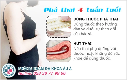 Phá thai 4 tuần có tội không?