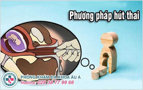 Phương pháp hút thai