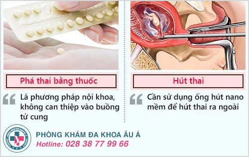 nên phá thai bằng thuốc hay hút thai