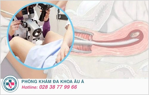phá thai 10 tuần