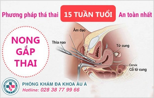 Phá thai 15 tuần có được không?
