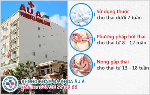 Phá thai 15 tuần có được không?