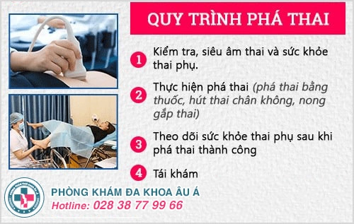 quy trình phá thai