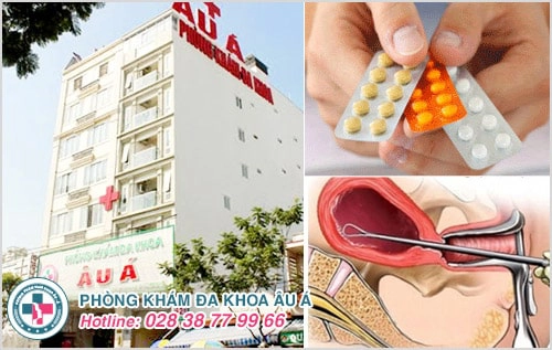 Thời gian uống thuốc phá thai cần tuân thủ đúng chỉ định bác sĩ chuyên khoa