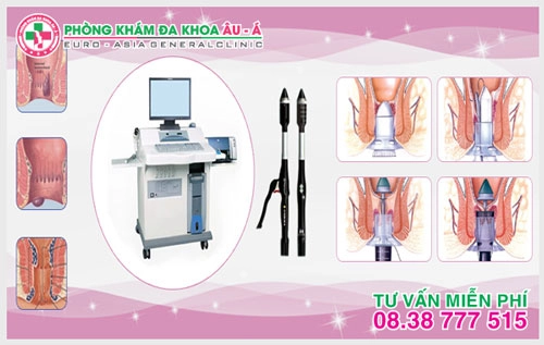 Cách hỗ trợ điều trị bệnh trĩ nội và trĩ ngoại hiệu quả