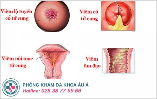 chậm kinh ra máu nâu