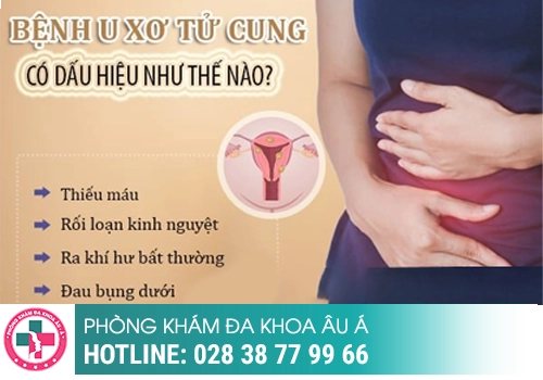 Rối loạn kinh nguyệt 1 tháng có 2 lần là bệnh gì? 