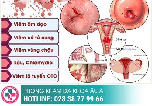 NHỮNG BỆNH VIÊM NHIỄM PHỤ KHOA THƯỜNG GẶP