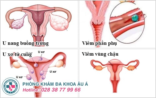 Tổng hợp những bệnh phụ khoa thường gặp ở nữ giới
