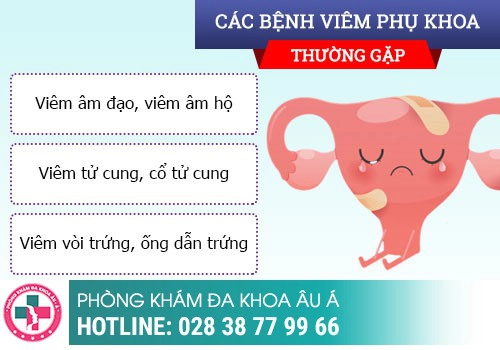 Không có thai nhưng lại trễ kinh nguyên nhân do đâu?