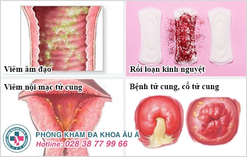 Tổng hợp những bệnh phụ khoa thường gặp ở nữ giới