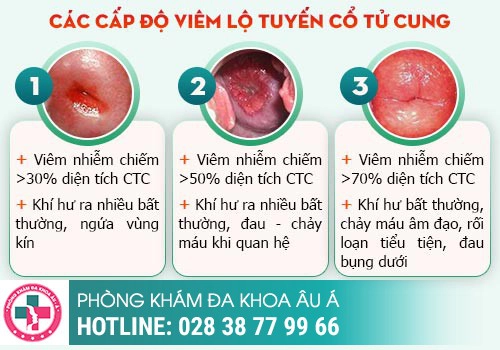 Bệnh phụ khoa nguy hiểm cần can thiệp gấp