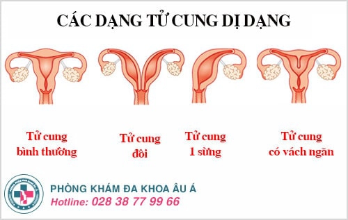 Cổ tử cung sừng hóa