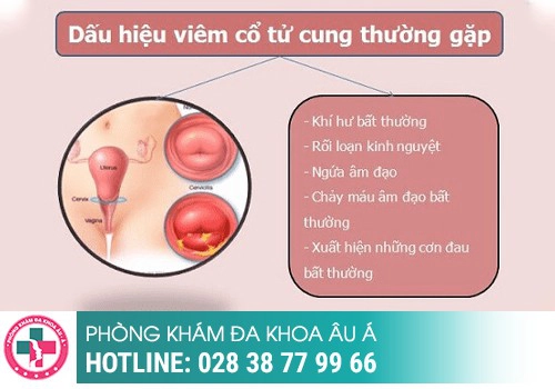 NGUYÊN NHÂN KHIẾN HUYẾT TRẮNG CÓ MÙI LẠ
