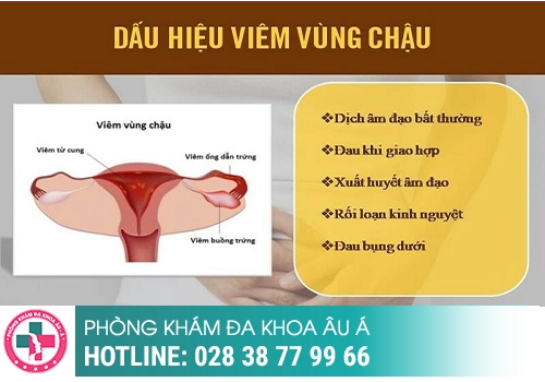 Viêm vùng chậu