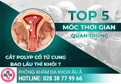 Phương pháp hỗ trợ điều trị Polyp cổ tử cung