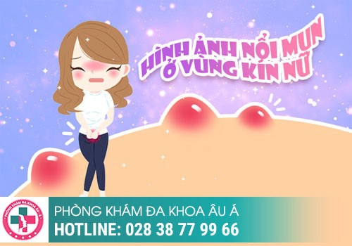 Các tình trạng bị nổi mụn ở vùng kín