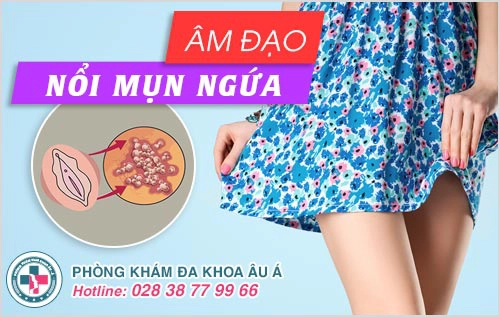 âm đạo mụn ngứa