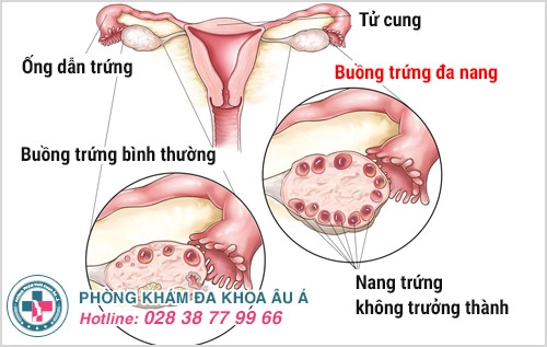 mất kinh nguyệt