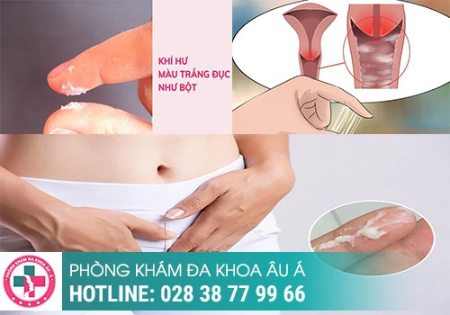 HUYẾT TRẮNG VÓN CỤC CẢNH BÁO BỆNH GÌ?