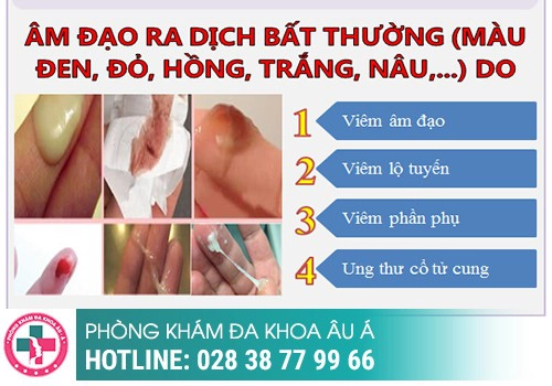 Huyết trắng màu nâu là bị gì?