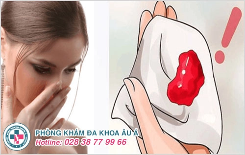 Kinh nguyệt có mùi hôi – Điều gì khiến chị em lo ngại?