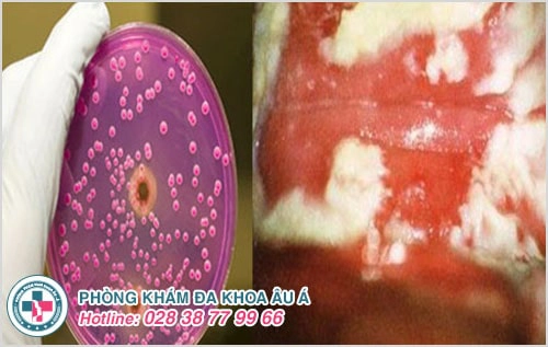 Đau vùng kín là dấu hiệu của bệnh gì?