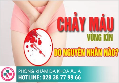 NGUYÊN NHÂN CHẢY MÁU ÂM ĐẠO LÀ GÌ?