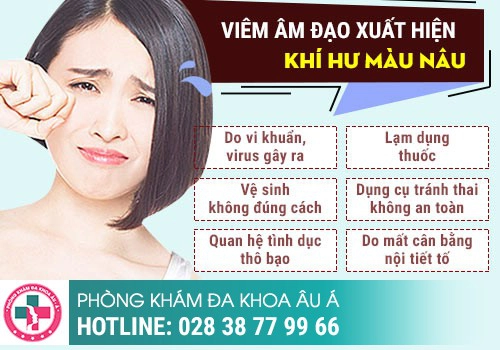 Ra khí hư nâu nhưng không ngứa là dấu hiệu của bệnh hay mang thai?