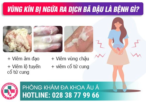 Nguyên nhân bị ngứa 2 bên mép vùng kín