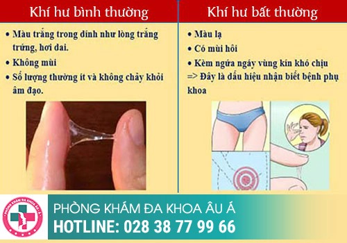 PHÂN BIỆT KHÍ HƯ VÀ DỊCH TIẾT ÂM ĐẠO