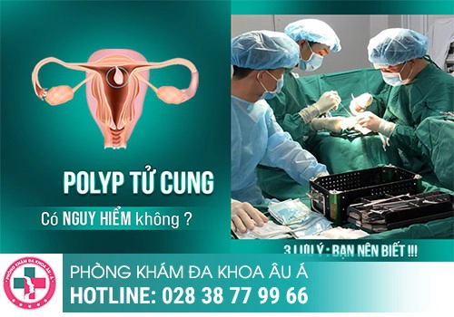 Polyp cổ tử cung có nguy hiểm không?