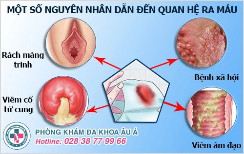 Quan hệ ra máu do bệnh gì gây nên? Có nguy hiểm không?