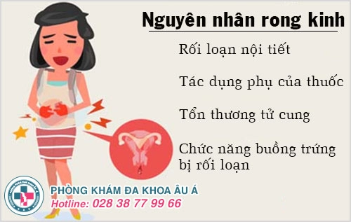 rong kinh
